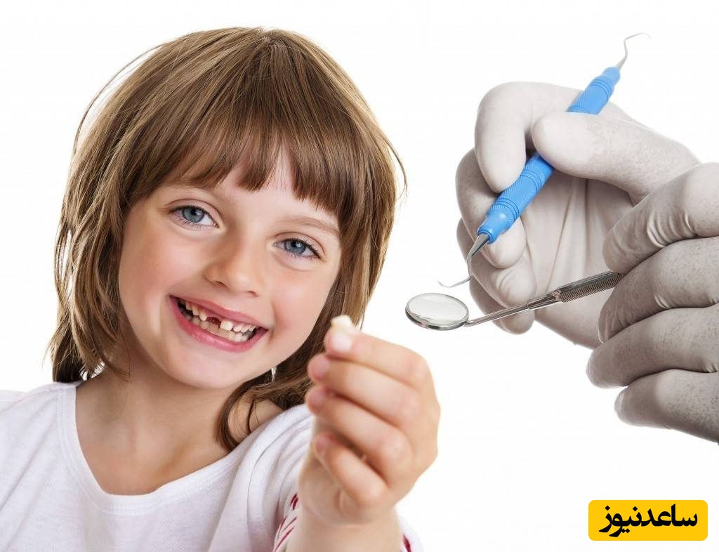 انواع عمل کشیدن دندان و طبقه بندی آن ها