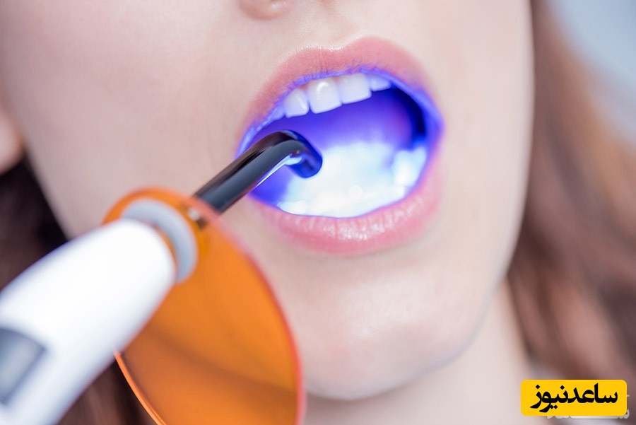 درای ساکت یا ساکت خشک چیست؟