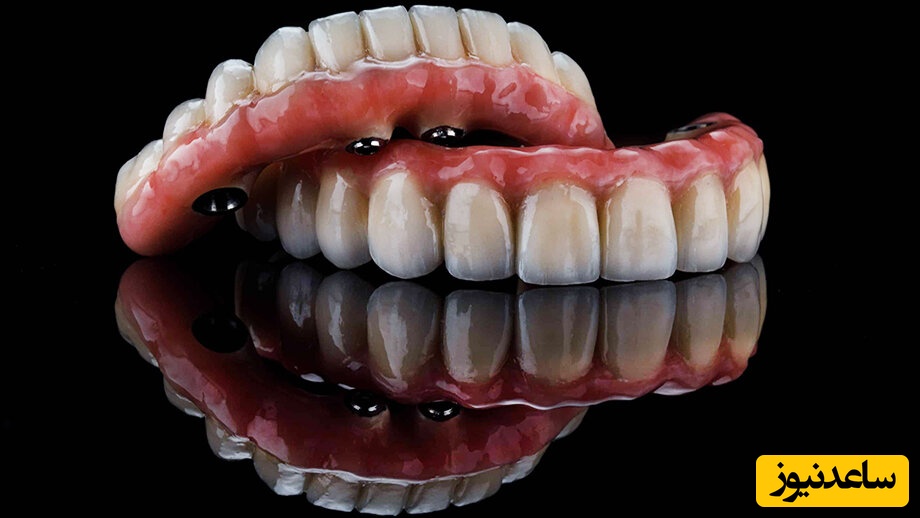کاربرد انواع مختلف دندان مصنوعی چیست؟