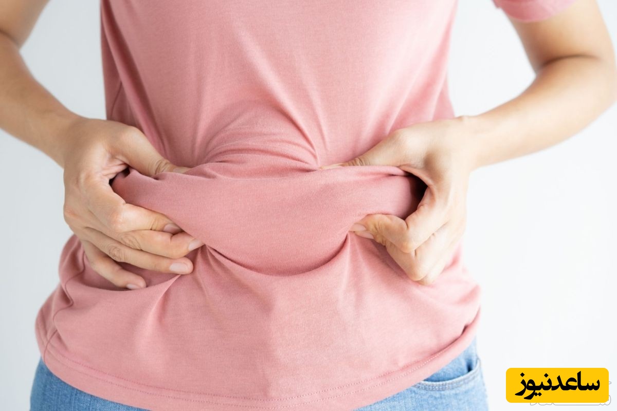 علت جدایش شکمی در بارداری و روش های درمان