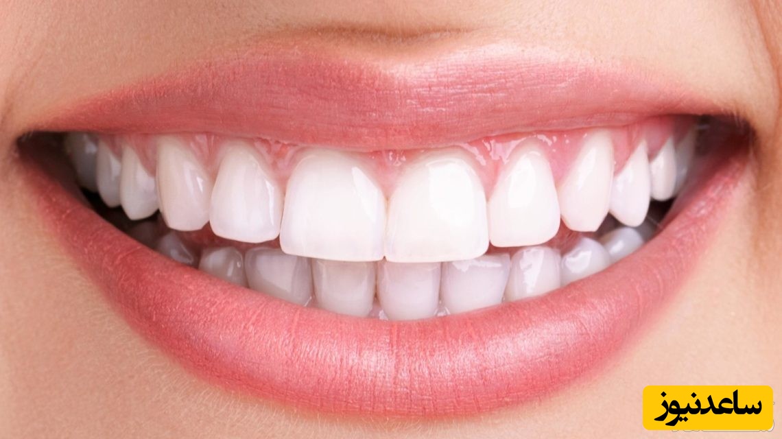 خوراکی های مضر برای دندان ها