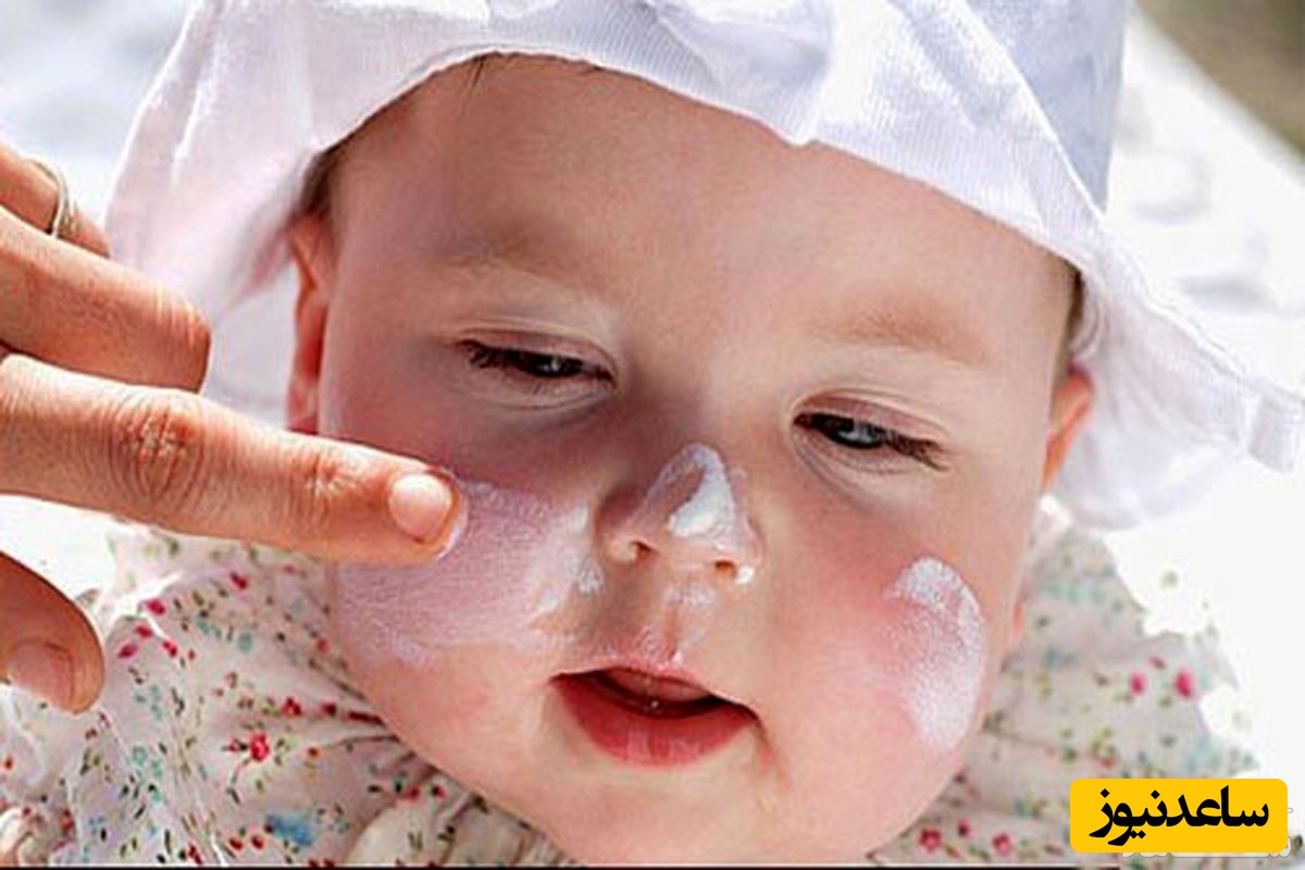 ضد آفتاب برای کودکان