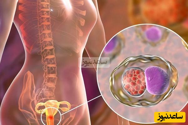 انواع سرطان دهانه رحم