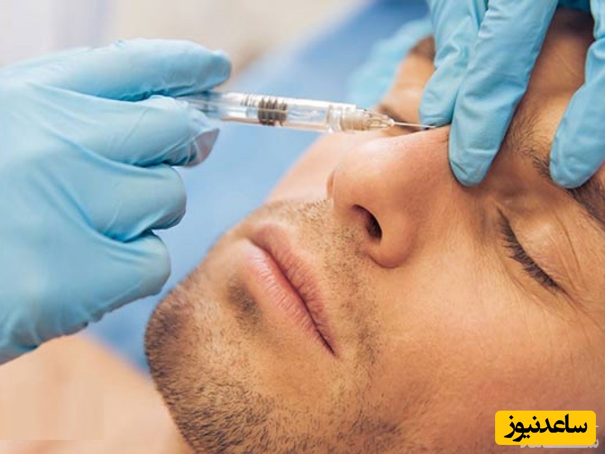خلق یک بینی روی پیشانی مرد چینی