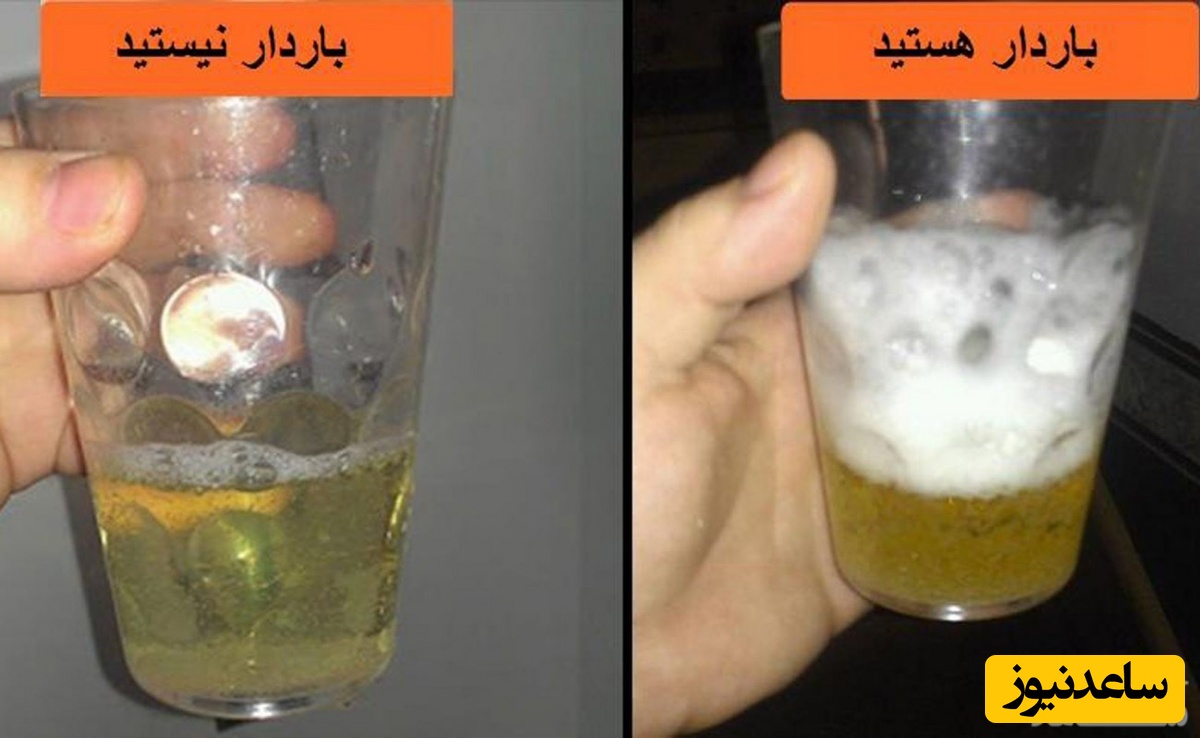 تست بارداری با شامپو