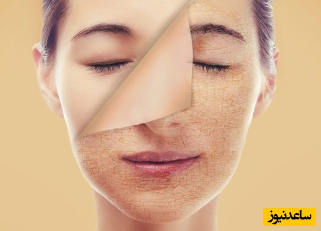 مراحل انجام فیشیال پوست چیست؟