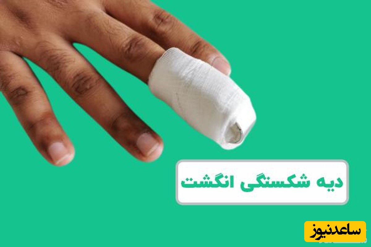 همه چیز درباره دیه جراحات انگشت و میزان آن