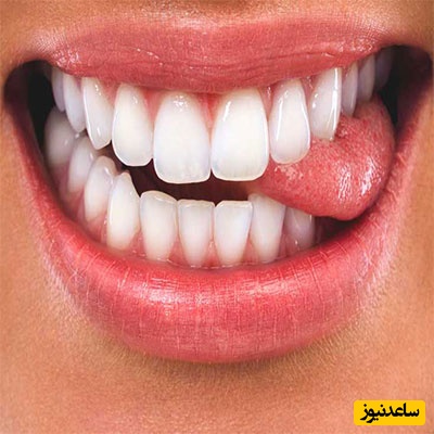 علت دندان قروچه در کودکان