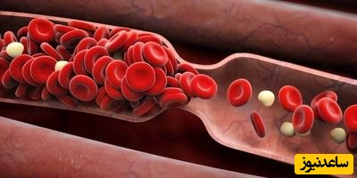 ایداروبیسین چگونه با سرطان خون مبارزه می‌کند؟