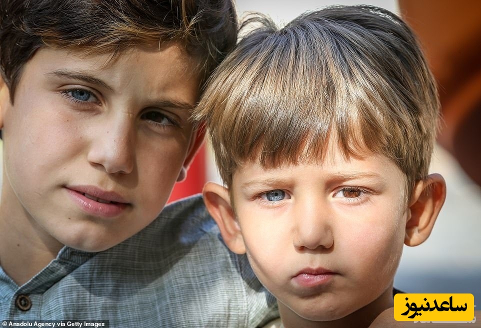 چشمان رنگی متفاوت