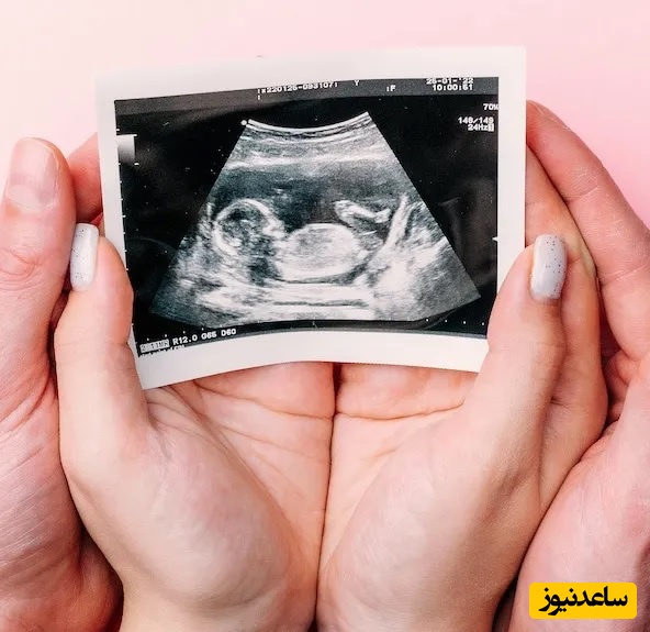تعرفه‌ها و هزینه‌های سونوگرافی‌های بارداری در سال 1404