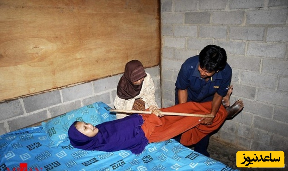 عکس های عجیب از زنی که شبیه چوب شده است!