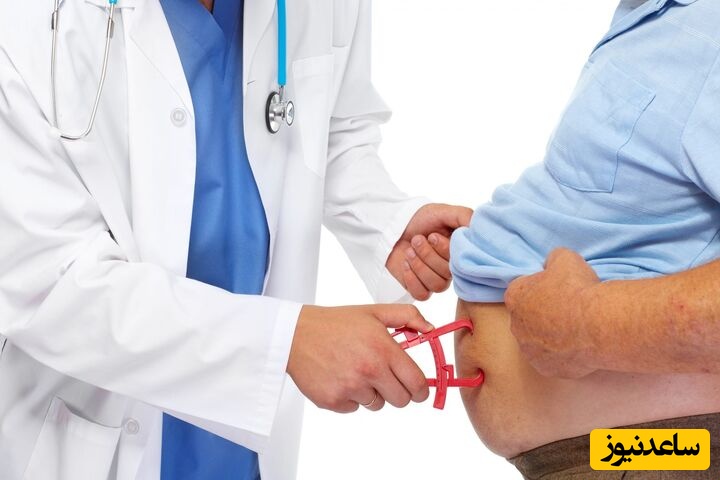 نجات از دیابت و فشار خون با عمل جراحی اسلیو معده