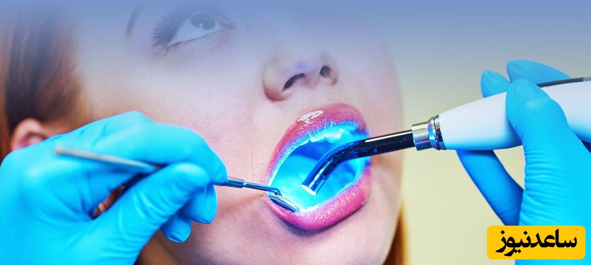 مزایای دندانپزشکی با لیزر چیست؟