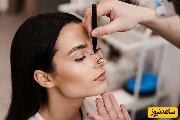 بهترین سن برای عمل بینی بعد از دوران بلوغ و رشد کامل استخوان