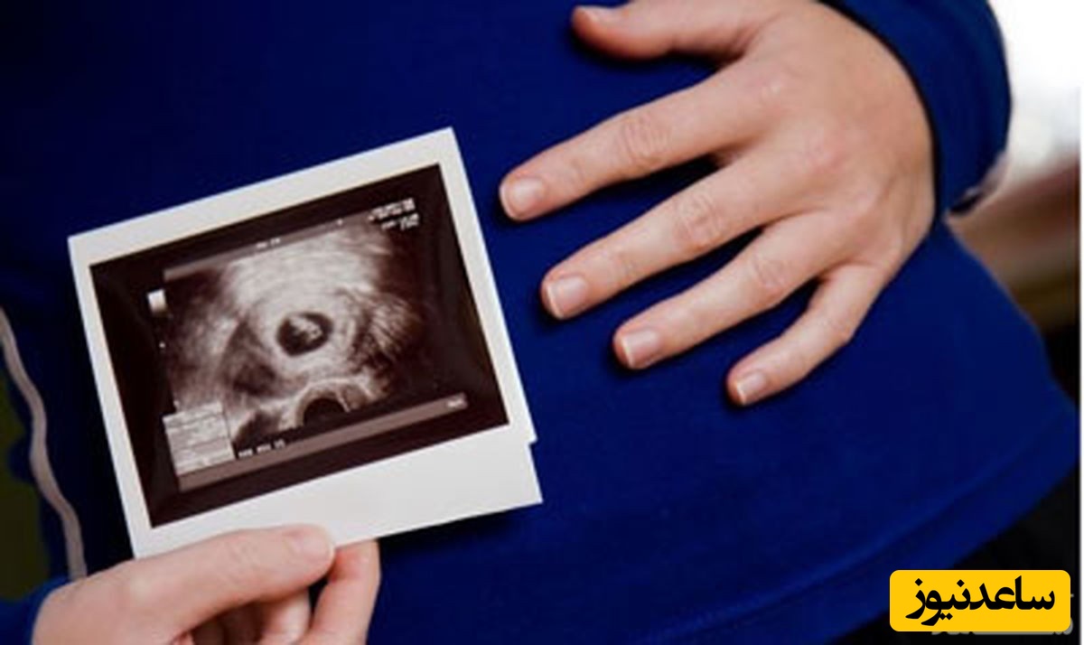 علل تشکیل نشدن ساک بارداری