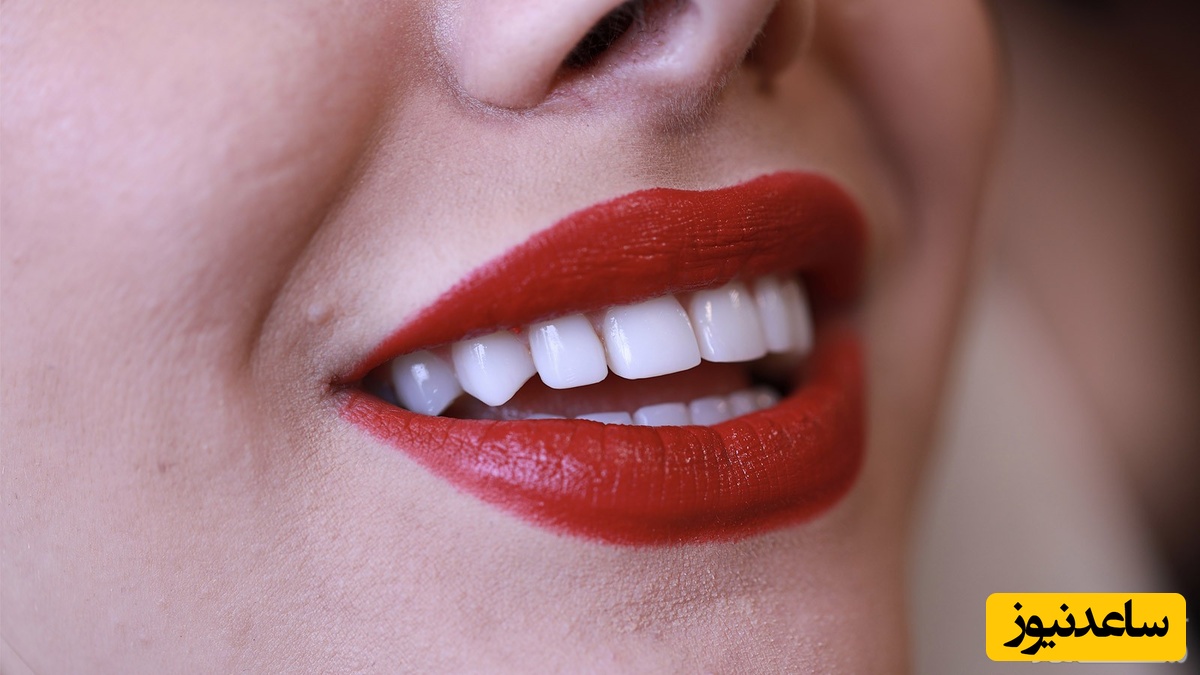 مینای دندان را طبیعی تقویت کنید