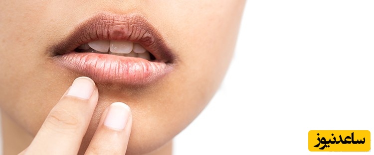 علت مزه فلز دهان در افراد مختلف چیست؟