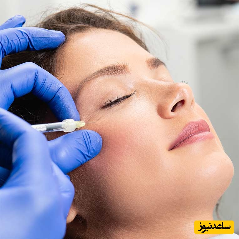 چگونه ظاهر پوستمان را با بوتاکس جوان‌تر کنیم؟
