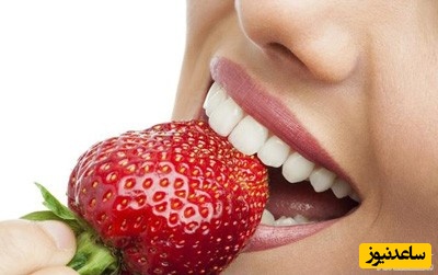 زیبایی دندان با کامپوزیت