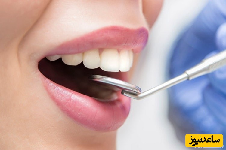 حقایقی در مورد سوراخ کردن دندان