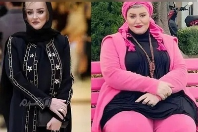 ویدئو/روایت قابل تامل نعیمه نظام‌دوست از جراحی خطرناک زندگی‌اش/لاغری به چه قیمتی؟