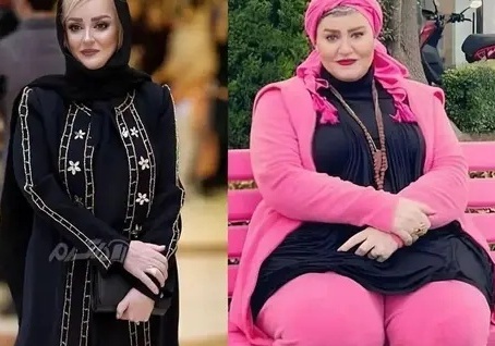 ویدئو/روایت قابل تامل نعیمه نظام‌دوست از جراحی خطرناک زندگی‌اش/لاغری به چه قیمتی؟