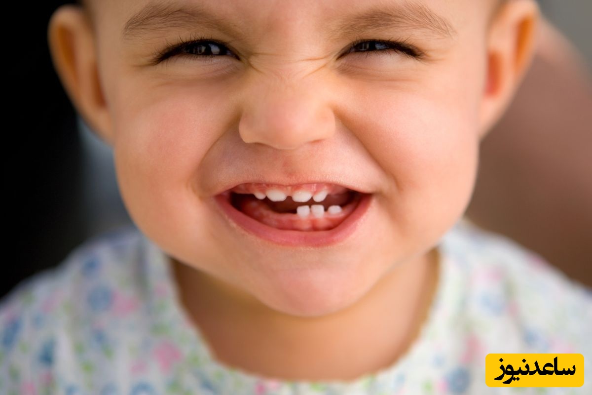 درمان پوسیدگی دندانهای شیری الزامی است؟
