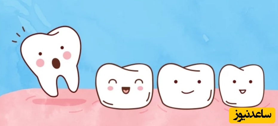 با لق شدن دندان دائمی کودک چه کنیم؟