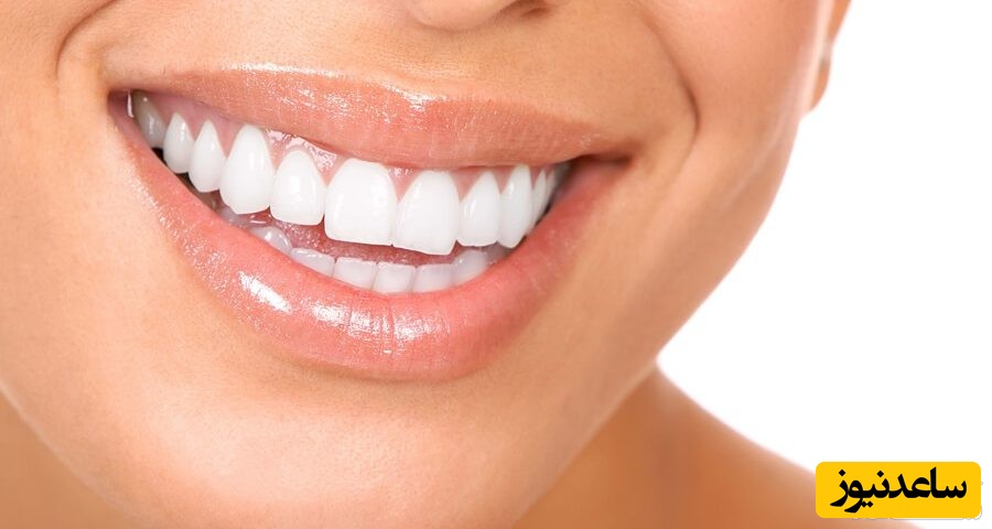 اگر قصد انجام باندینگ دندان دارید بخوانید