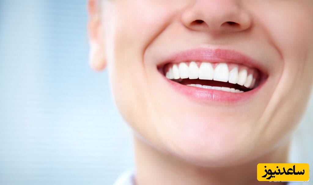 مراقبت های لازم بعد از انجام بلیچینگ (سفید کردن و جرم گیری) دندان