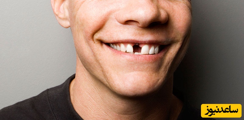 عوارض بی دندانی چیست؟