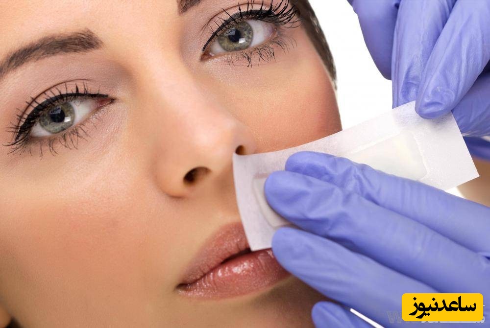 درمان سریع زخم های دهان با چند روش اعجاب انگیز