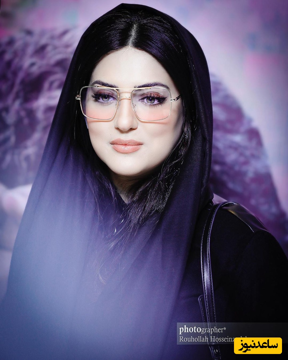 هلیا امامی هم به تزریق رو آورد! جزئیات عمل های زیبایی و تزریق های هلیا امامی را اینجا ببینید.