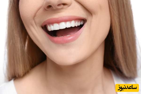 روش هایی برای پر کردن جای خالی دندان