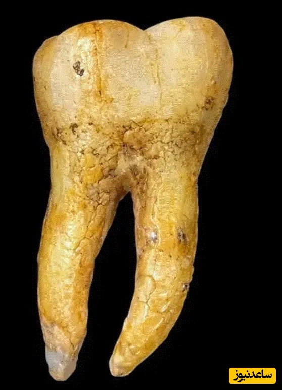 دندان جواهرنشان تمدن مایا که در گواتمالا پیدا شد