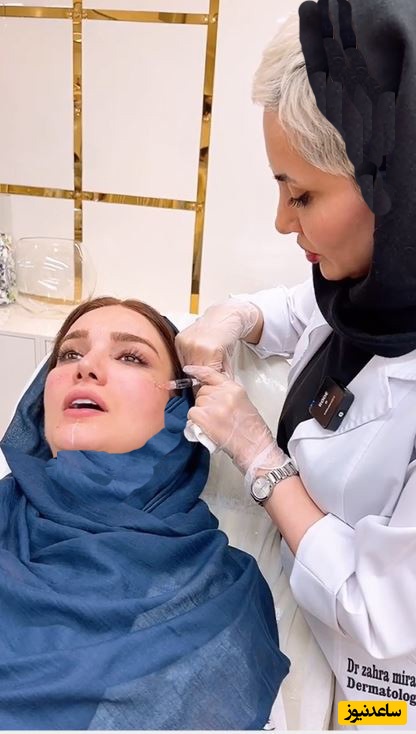 ویدیویی از متین ستوده عروس خانوم قدبلند در حال تزریق ژل و انجام کارهای زیبایی بر روی صورتش؛ برای عروسی حسابی پوستش آماده بود!