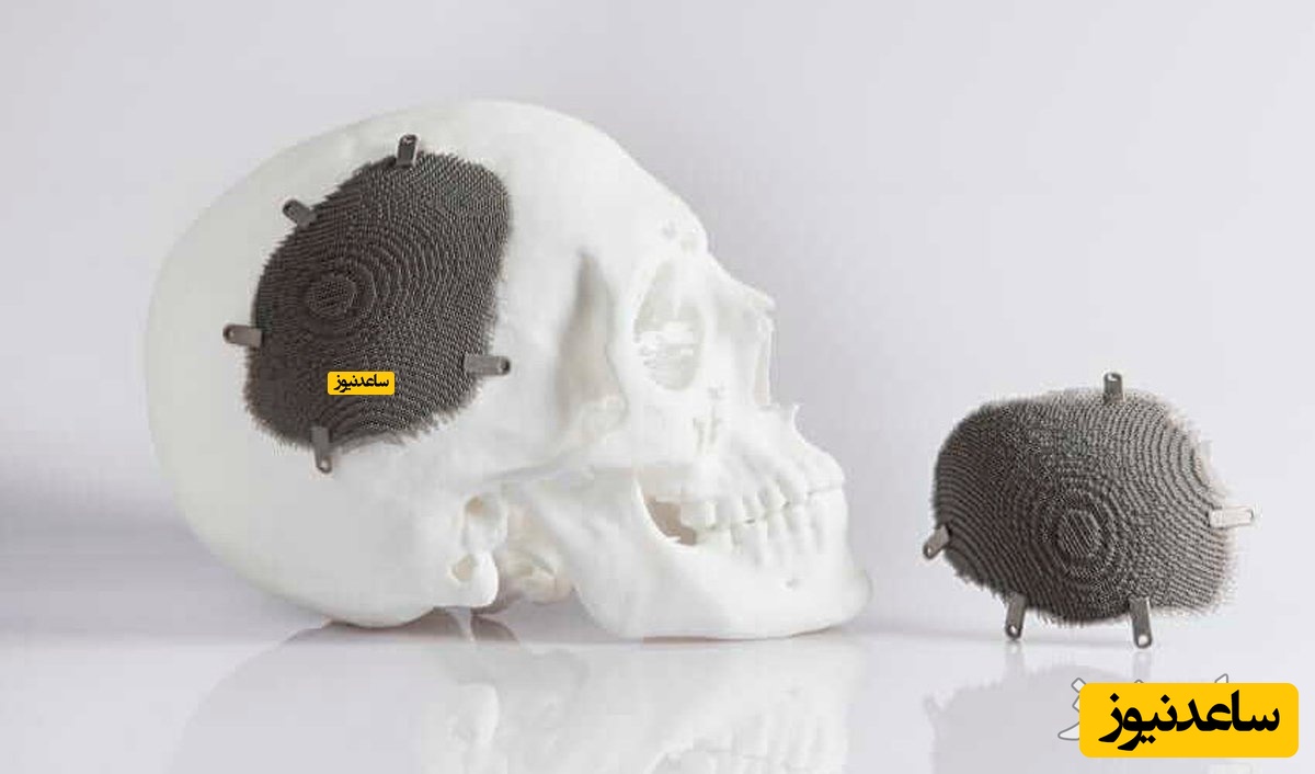 پربینت سه بعدی پزشکی تبریز اینوفب