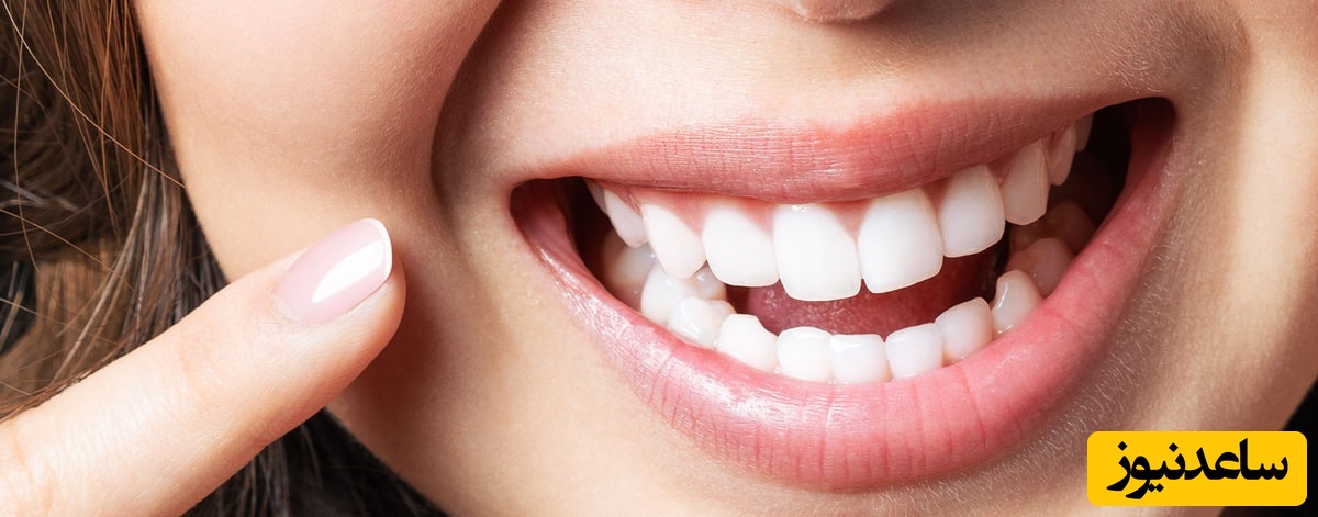 طراحی لبخند چیست؟ و انواع عکس طرح لبخند