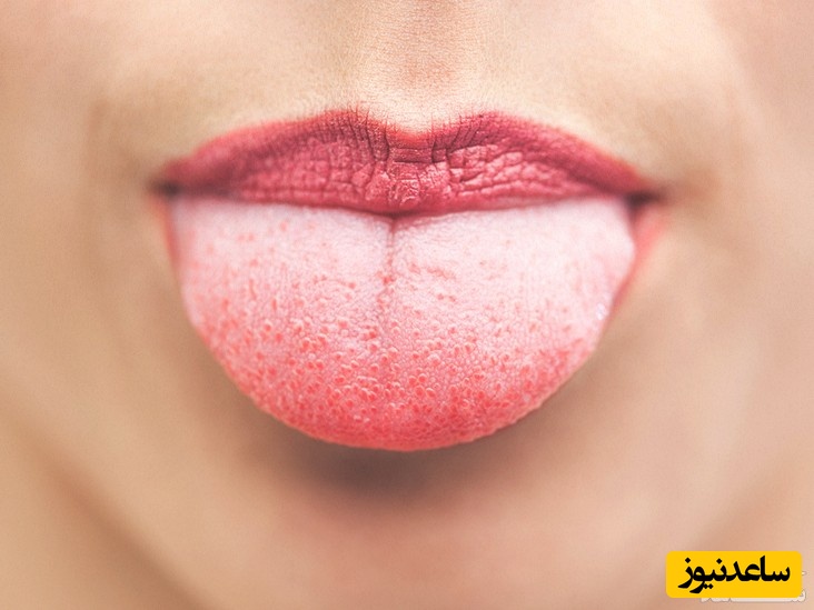 چرا نوک زبان مان گزگز  میشود؟