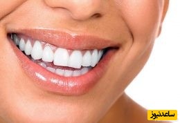 مضرات پفک و نوشابه برای دندان