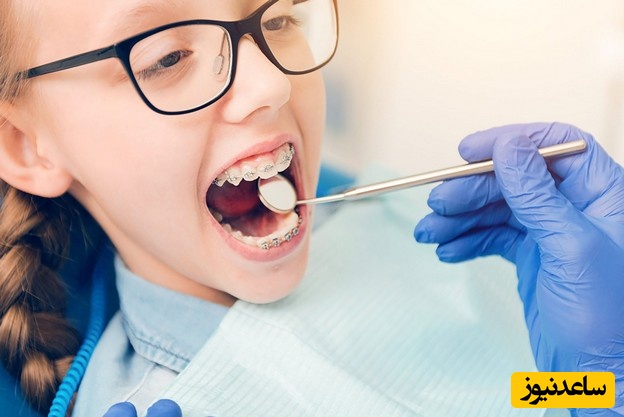 دوره ارتودنسی کودکان چقدر است؟