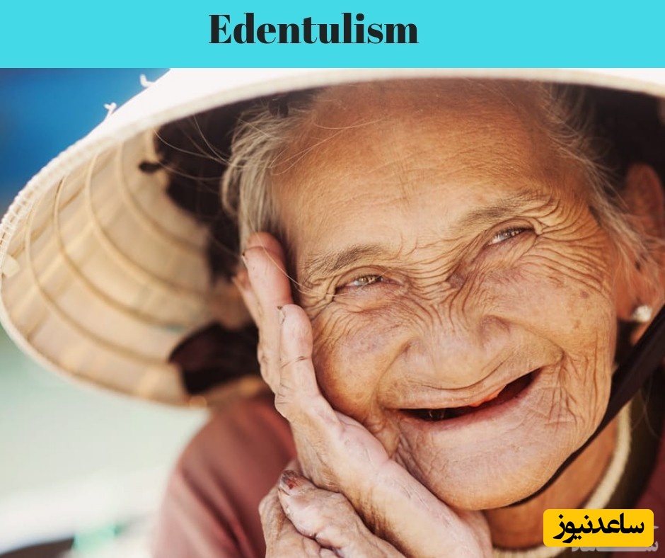 از دست دادن دندانها (ادنتولیسم) علل و راه های پیشگیری و درمان