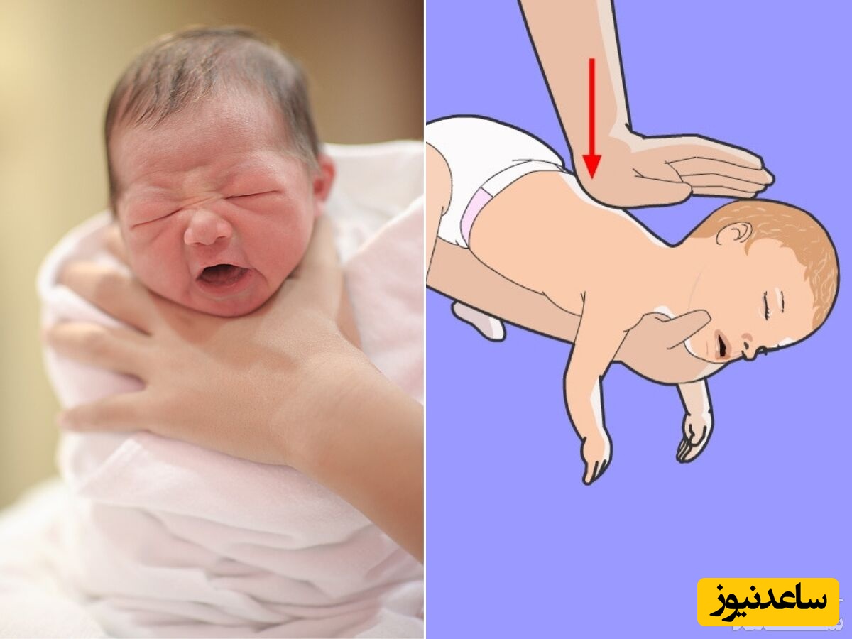 خارج کردن اجسام از گلوی کودک