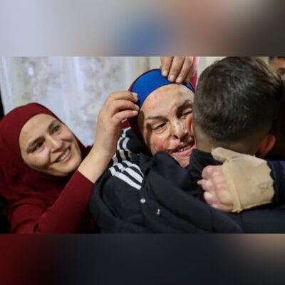 (ویدئو) راز صورت سوخته زن فلسطینی که از اسارت آزاد شد