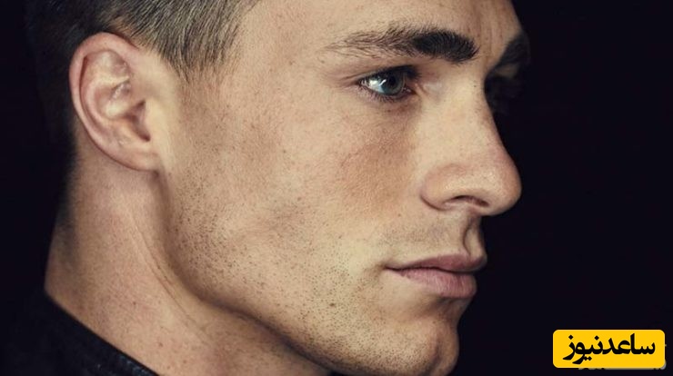 سوالات متداول در مورد جراحی فک و صورت