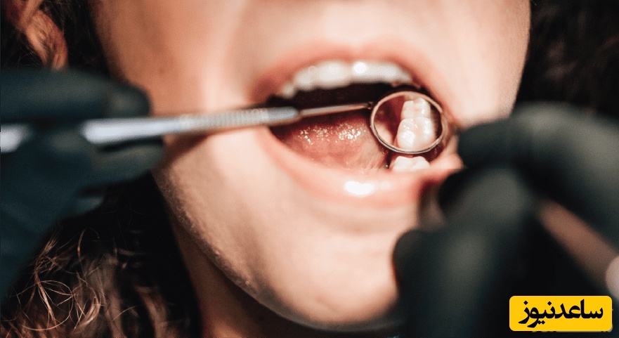 عصب کشی دندان چه موقع انجام بگیرد بهتر است؟