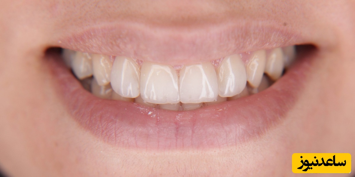 فرم دندان‌ها درباره شخصیت چه می‌گوید؟