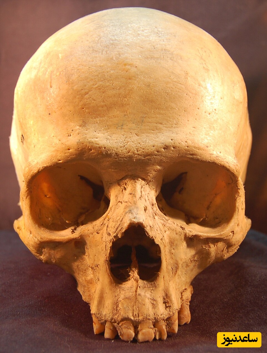 (تصاویر) کشف جمجمه 6000 ساله با شواهد حیرت‌انگیز از جراحی گوش؛ رازهای پنهان تاریخ پزشکی که تصورات ما را به چالش می‌کشد