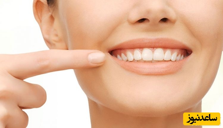 رفع پلاک دندان در خانه با چند روش ساده